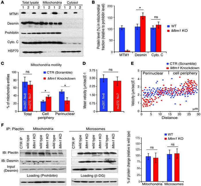 The MTM1-desmin complex is associated with mitochondria and is involved ...