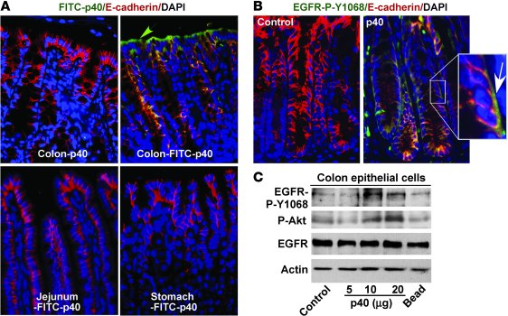 Delivery of p40 to the colon using pectin/zein hydrogel beads activates ...
