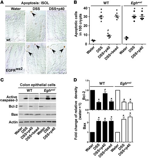 EGFR kinase activity is required for p40-mediated inhibition of DSS-indu...