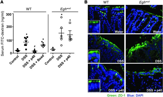 EGFR kinase activity is required for p40 to prevent DSS-induced disrupti...