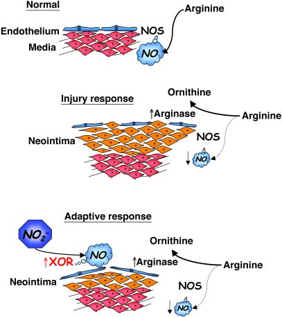 Schematic representation of vascular injury–induced arginase and XOR and...