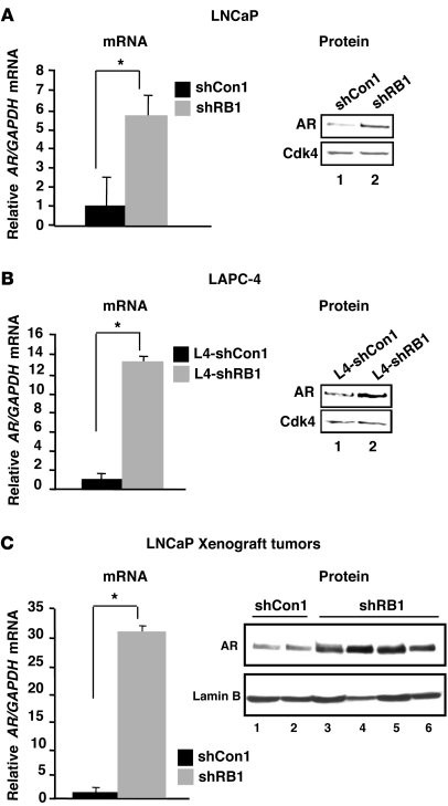 AR expression is induced in RB-deficient cells.
(A) AR mRNA was monitore...