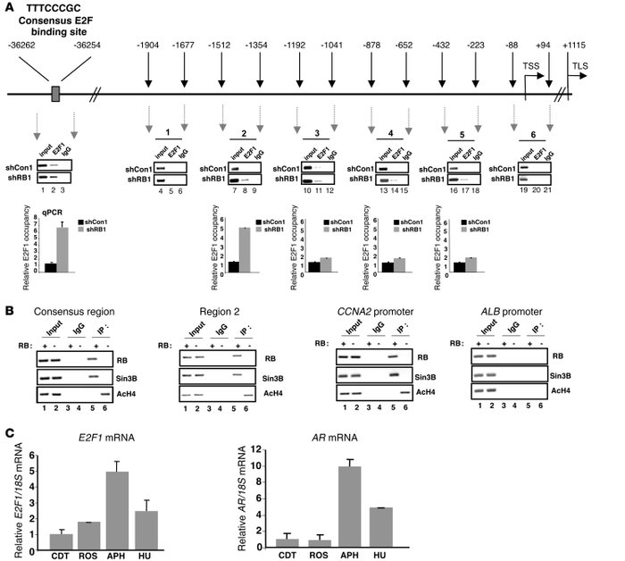 The RB/E2F1 axis regulates the AR locus, and the kinetics of E2F1 and AR...