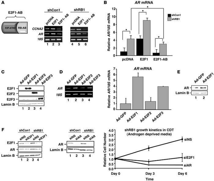 Selective restoration of RB activity at sites of E2F1 action suppresses ...