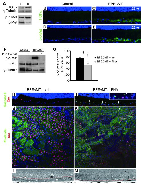 Activation of the HGF/c-Met pathway in RPEΔMT mice is critical for RPE c...