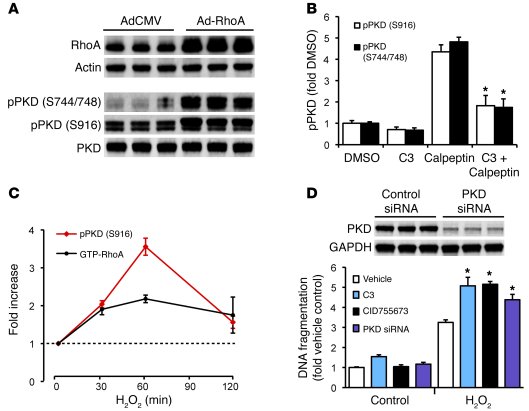 RhoA induces PKD activation in NRVMs.
(A) Adenoviral expression of RhoA ...