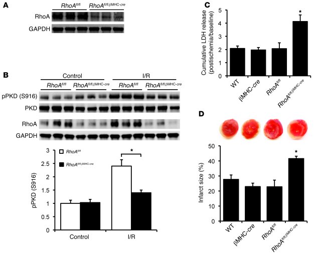 Cardiac-specific RhoA knockout enhances I/R injury in the heart.
(A) Rep...