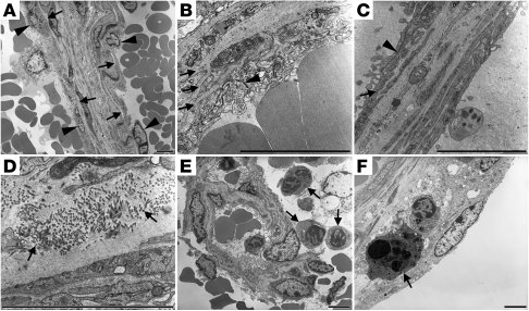 Ultrastructural findings in murine cavernous malformations.
(A) Dilated ...