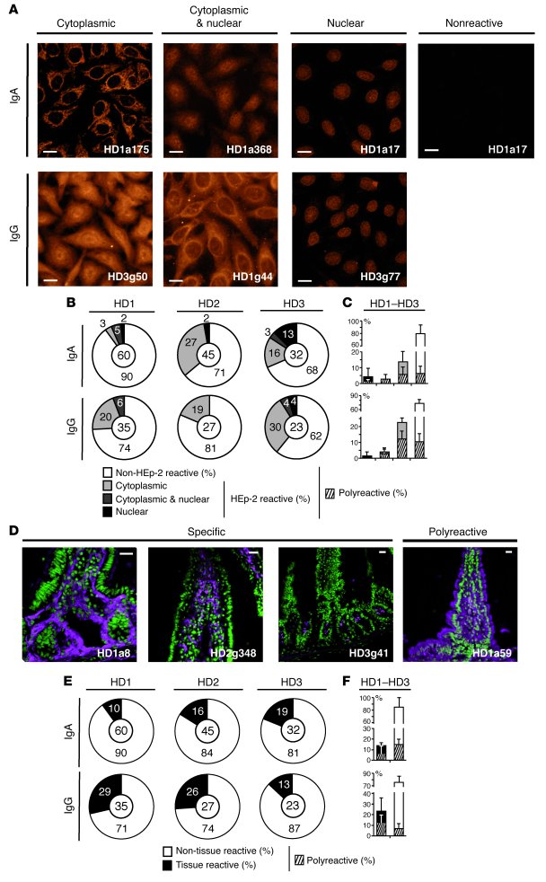 Self-reactivity of IgA and IgG lamina propria plasmablasts.
IgA and IgG ...