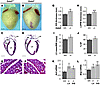 Mild LV hypertrophy of Gata5–/– mice.