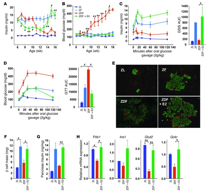 E2 prevents β cell failure in male ZDF rats.
(A–D) Random fed plasma ins...