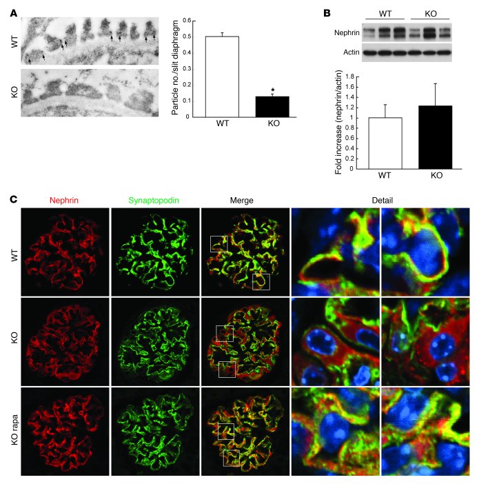 Hyperactivation of mTORC1 leads to mislocalization of slit diaphragm pro...