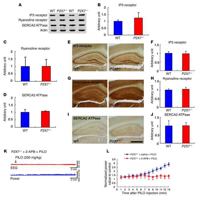 ICR-related molecules in the hippocampi of WT and P2X7–/– mice.
   
(A) ...