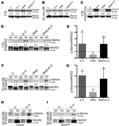 IL-2 stimulation of NK cells induces WASp-independent WAVE2 phosphorylat...