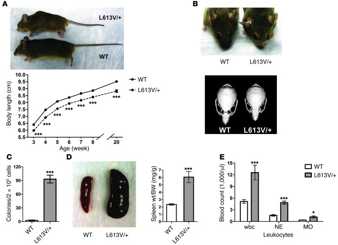 L613V/+ mice show multiple NS phenotypes.
(A) Short stature in L613V/+ m...