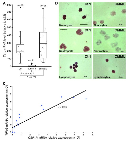 TIF1γ is downregulated in 35% of CMML patients.
(A) RQ-PCR analysis of T...