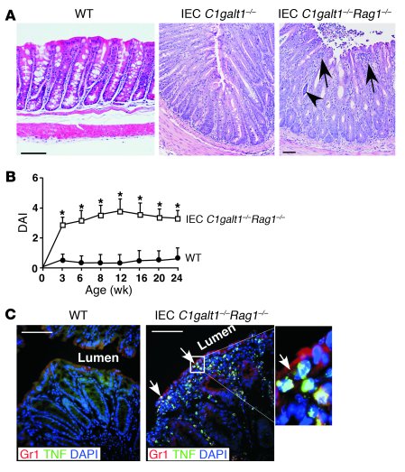 Adaptive immunity is not required for the initiation of colitis in IEC C...