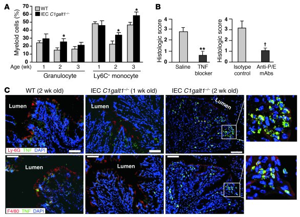 Innate immune cells are a critical initiator of colitis in IEC C1galt1–/...