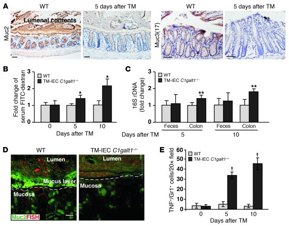 Absence of core 1–derived O-glycans impairs the levels of intestinal muc...
