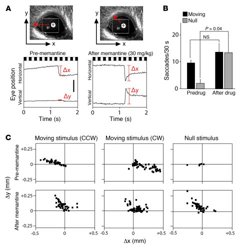 Memantine induces saccades with a large vertical component.
(A) Represen...