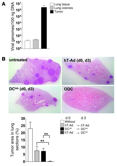 Immune responses induced by DC vaccination during viral tumor inflammati...