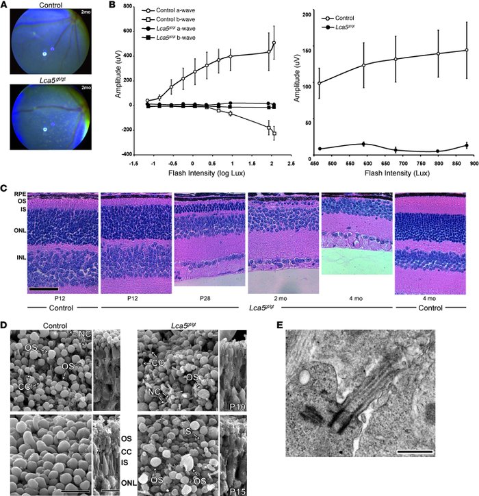 Clinical and morphological assessment of Lca5gt/gt mouse retina.
   
(A)...