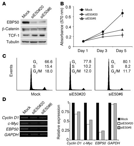 EBP50 knockdown blocks cell cycle progression and inhibits cell prolifer...