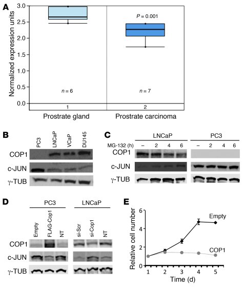 Inverse correlation between COP1 and c-JUN protein levels in human prost...