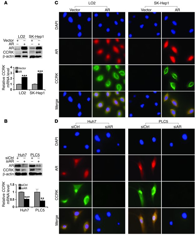 AR positively regulates CCRK transcript and protein expression in liver ...