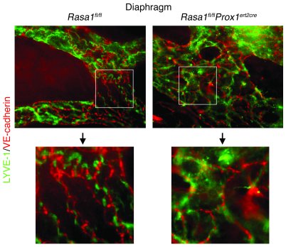 Junctional integrity of lymphatic vessels in induced RASA1-deficient mic...