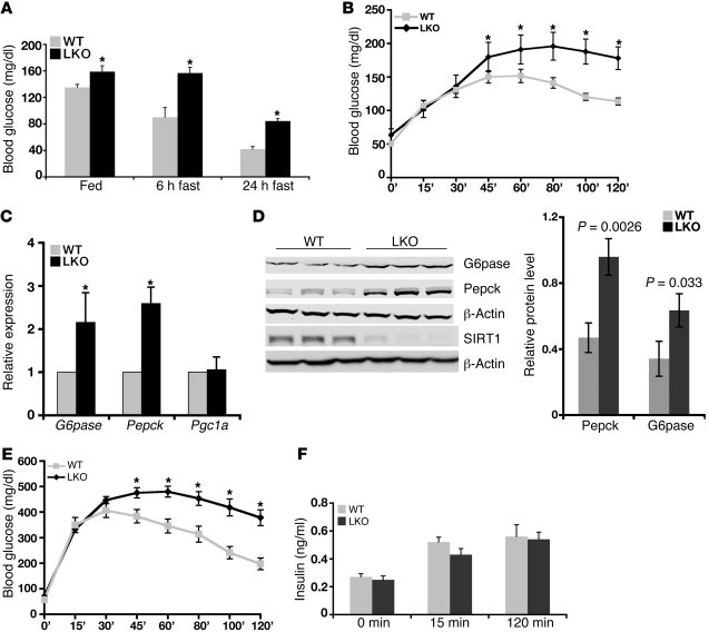 Liver-specific deletion of SIRT1 causes increased hepatic glucose produc...
