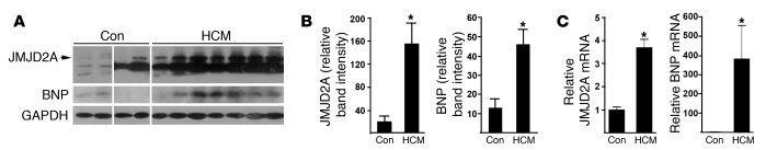 JMJD2A is upregulated in human hypertrophic hearts.
(A) Heart tissue sam...