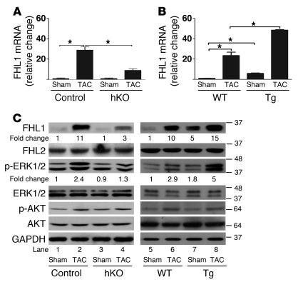 JMJD2A upregulates the expression of FHL1.
qRT-PCR analysis of transcrip...