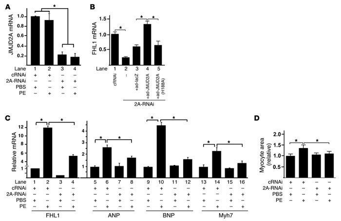 Downregulation of JMJD2A attenuates the expression of FHL1 and PE-activa...