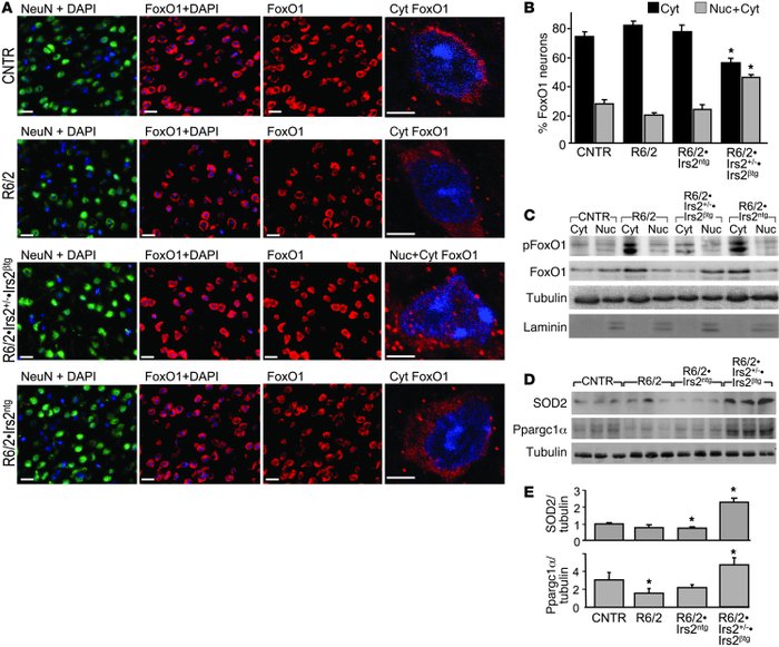 Effect of Irs2 signaling on FoxO1 activity in brains of R6/2 mice.
(A) F...