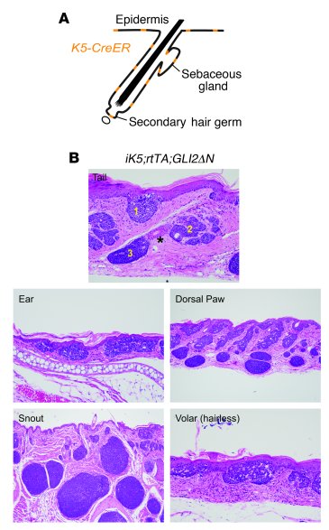 Induction of GLI2ΔN expression leads to BCC-like tumors derived from all...