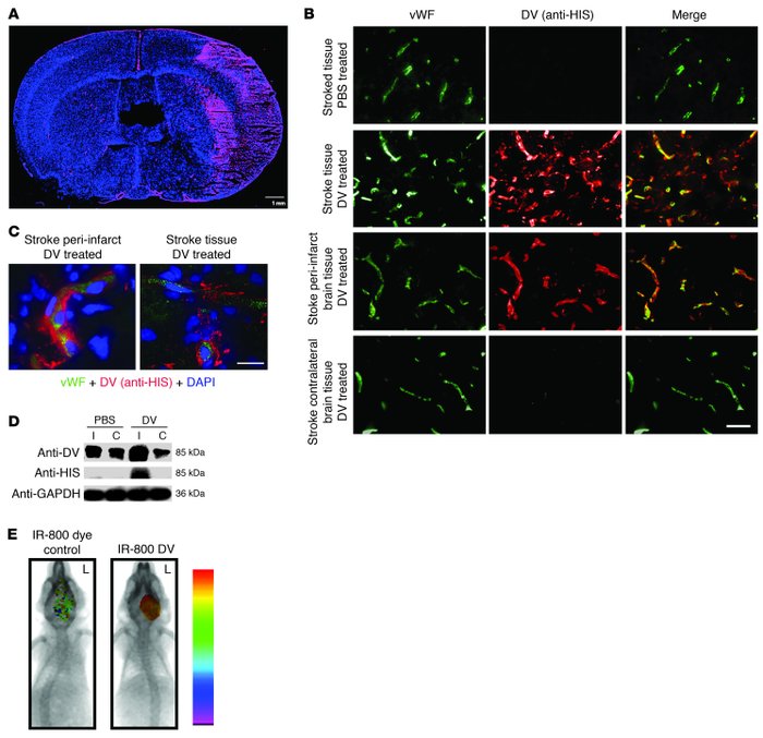 Administered DV reaches stroke brain tissue.
(A) PSD 5 rat brain immunos...