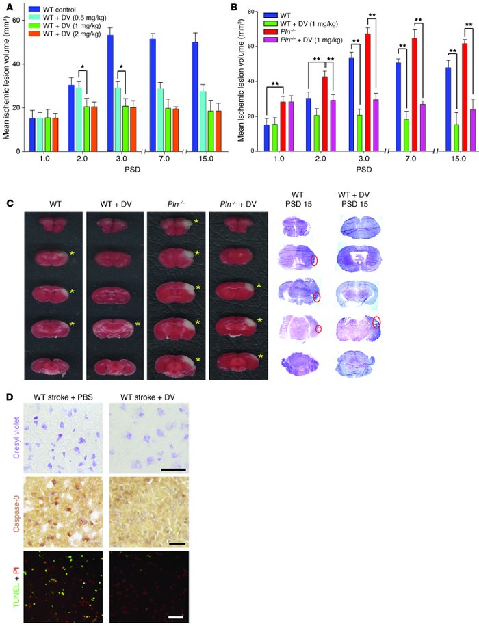 DV is neuroprotective.
(A and B) Mean ischemic lesion volumes measured f...