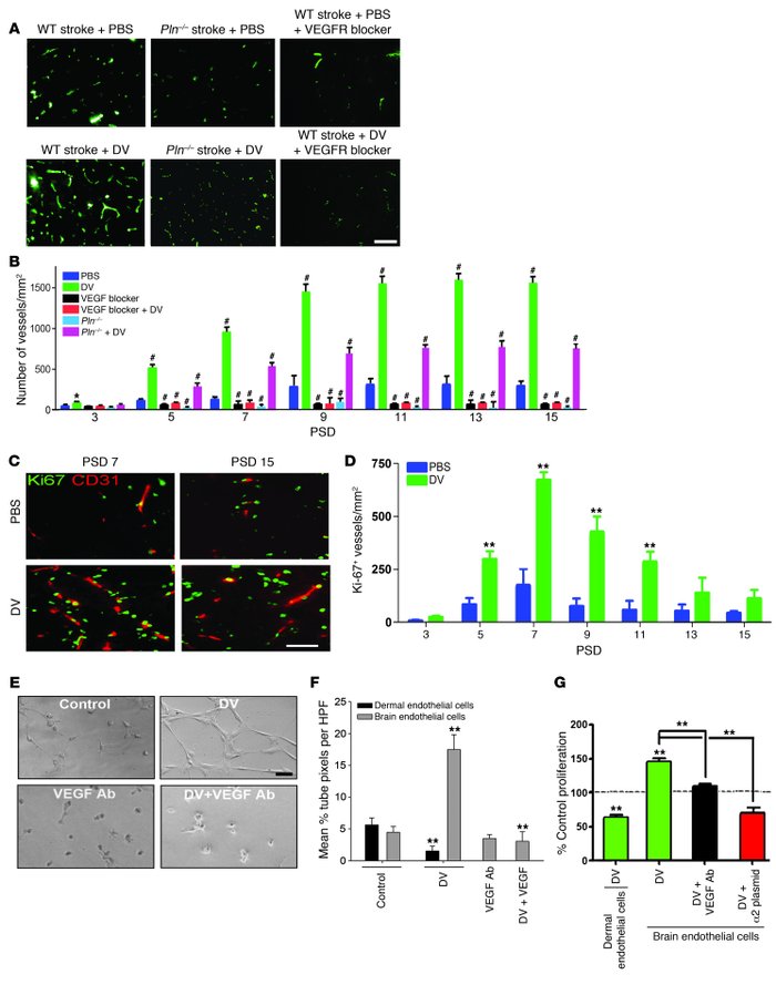 DV increases brain angiogenesis in a VEGF- and VEGFR-dependent fashion.
...