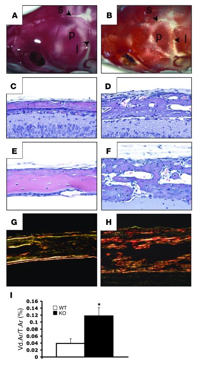 Intramembranous bone formation is defective in GsαOsxKO mice.
   
(A and...