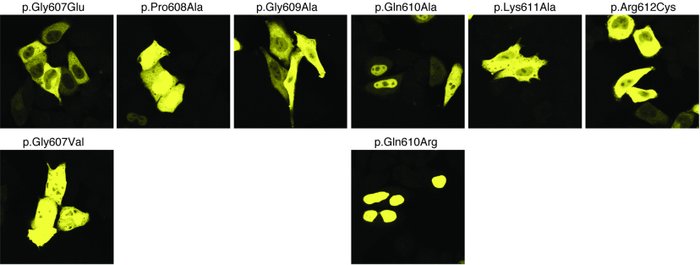 YFP-GKRP C-terminal variants have an important role in nuclear localizat...