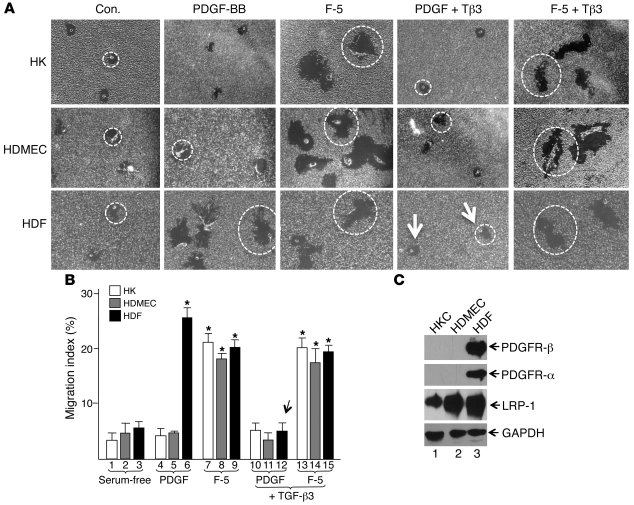 F-5 is a common promotility factor and overrides inhibition by TGF-β.
Pr...