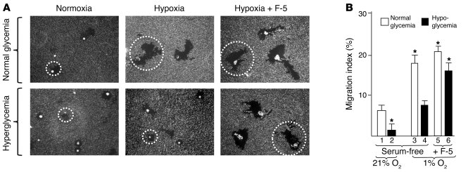 F-5 rescues cell migration under hyperglycemia.
(A) Primary HDFs were cu...