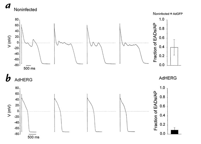 HERG overexpression suppresses EADs. (a) Noninfected and AdGFP-infected ...