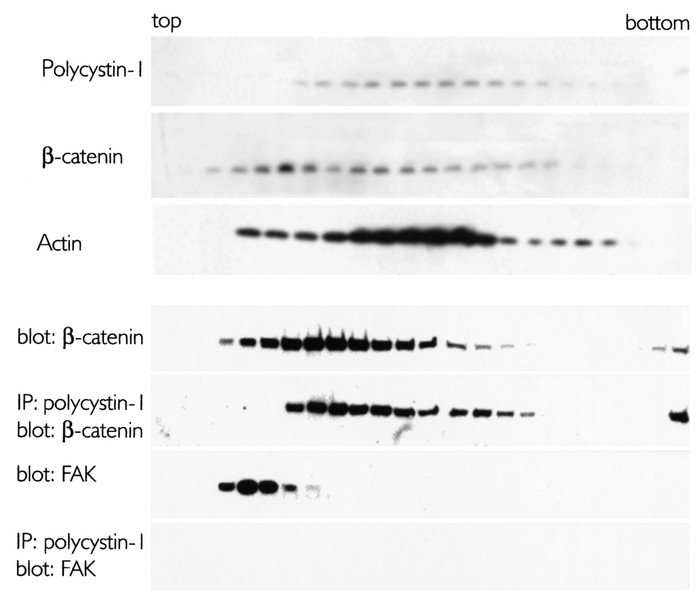 Sucrose density gradient centrifugation of HPAC cell lysates. Top: Distr...