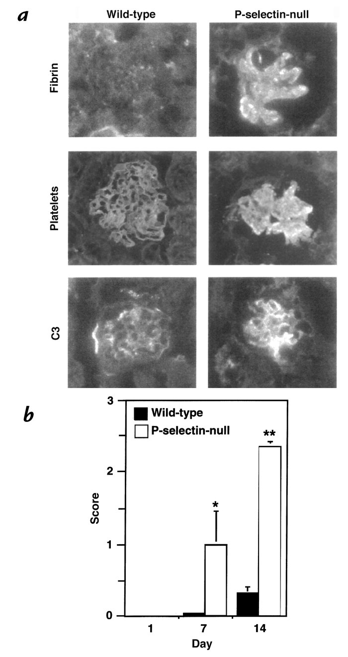 Evaluation of glomerular fibrin/fibrinogen, platelet, and complement C3 ...