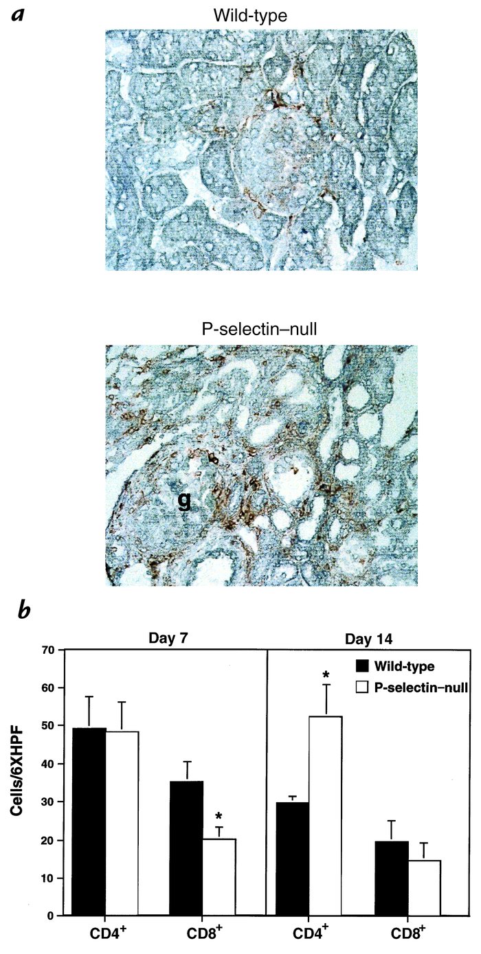 Immunohistochemical localization of interstitial macrophage and CD4+ and...