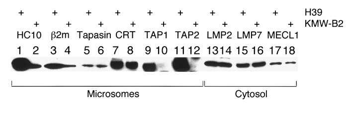 Western blot analysis of H39 and KMW-B2 cells. The microsomes and cytoso...