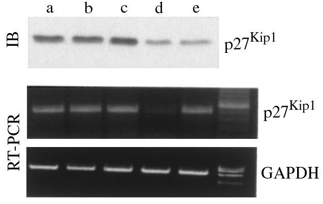 Suppression of p27Kip1 mRNA and protein with antisense ODN treatment of ...