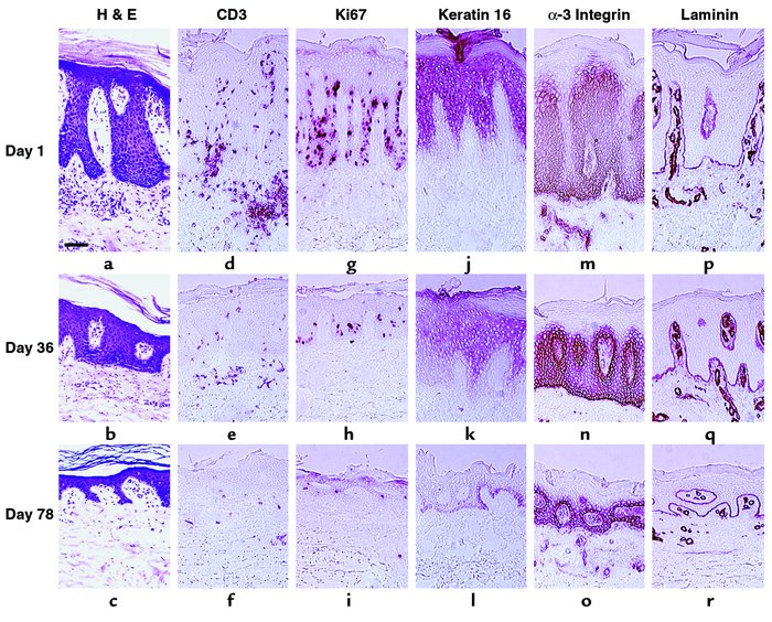Reversal of molecular markers of epidermal and vascular pathology follow...